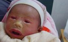 生殖医院有第三代试管婴儿技术吗？