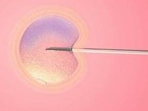 降调长方案和短方案的三大区别分享，选择哪种好一看便知