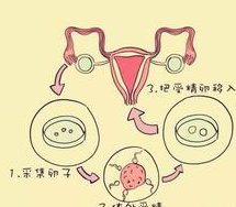 郑州三代试管技术怎么样？需要注意哪些问题？