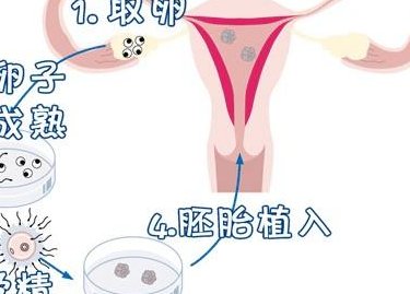 济南第三代试管婴儿医院哪家好